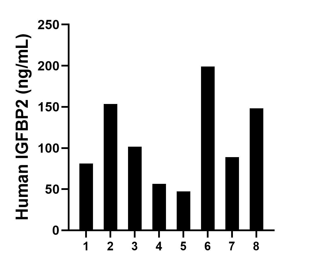 Serum of eight individual healthy human donors was measured. The IGFBP2 concentration of detected samples was determined to be 109.5 ng/mL with a range of 47.4 - 199.1 ng/mL.
